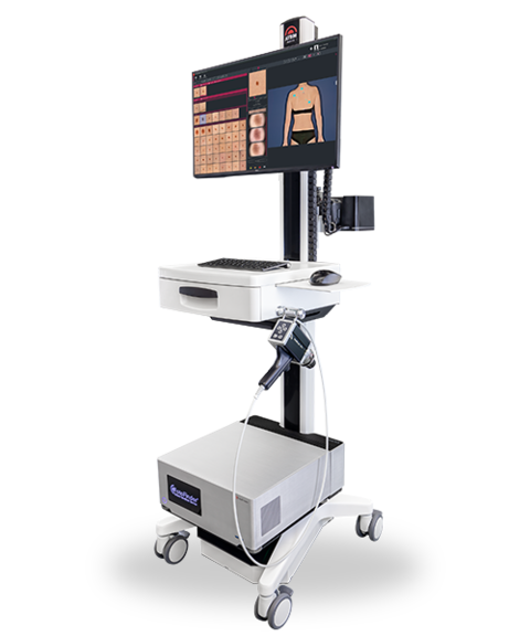 FotoFinder System für Automatisches Total Body Mapping